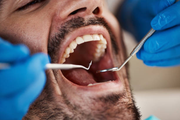 Professional Emergency Dental Service in OR